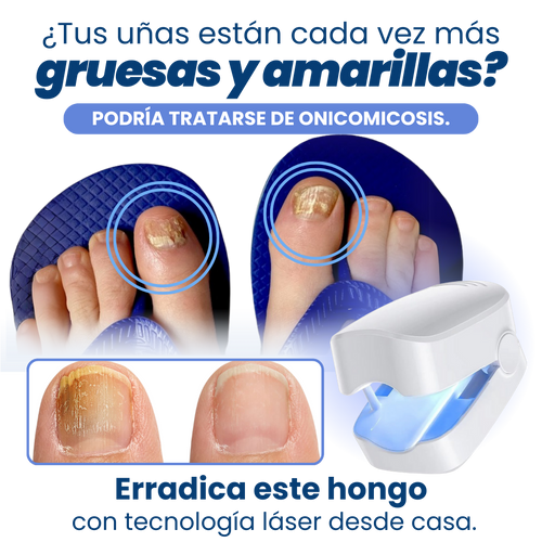 LAMPARA LASER UÑAS