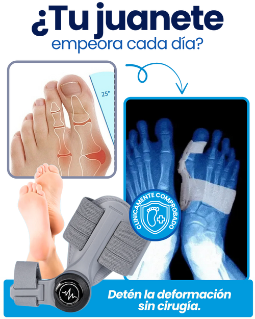 CORRECTOR JUANETES