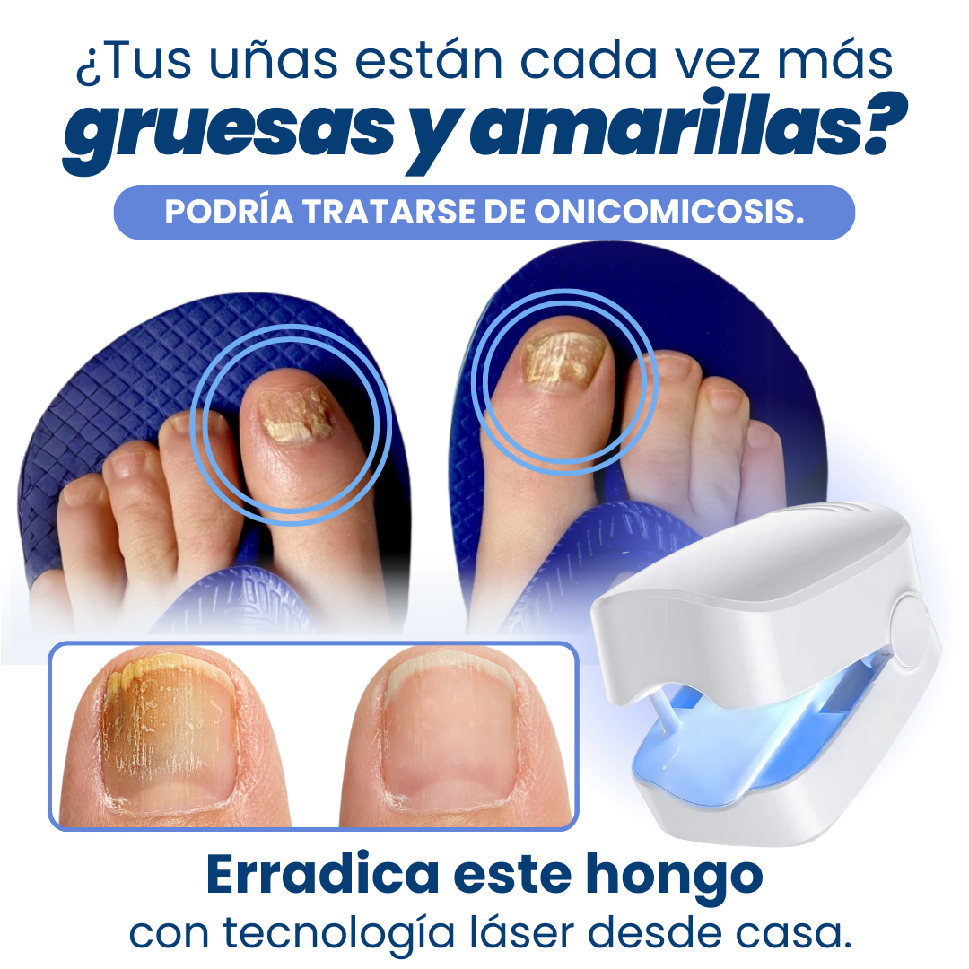 LAMPARA LASER UÑAS