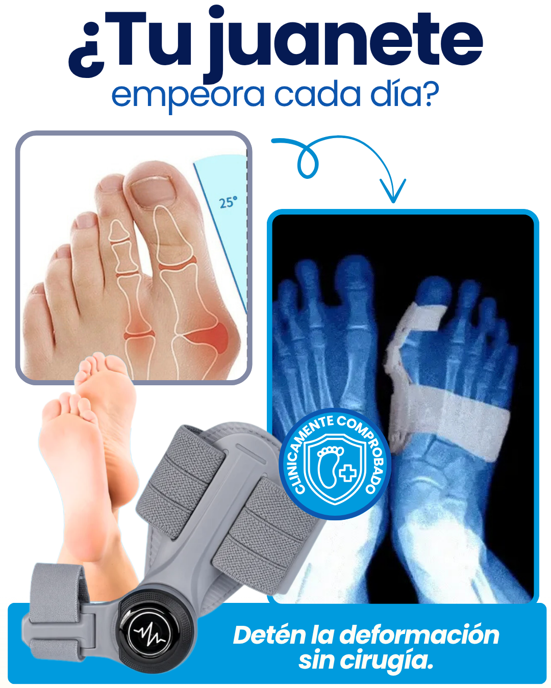 CORRECTOR JUANETES